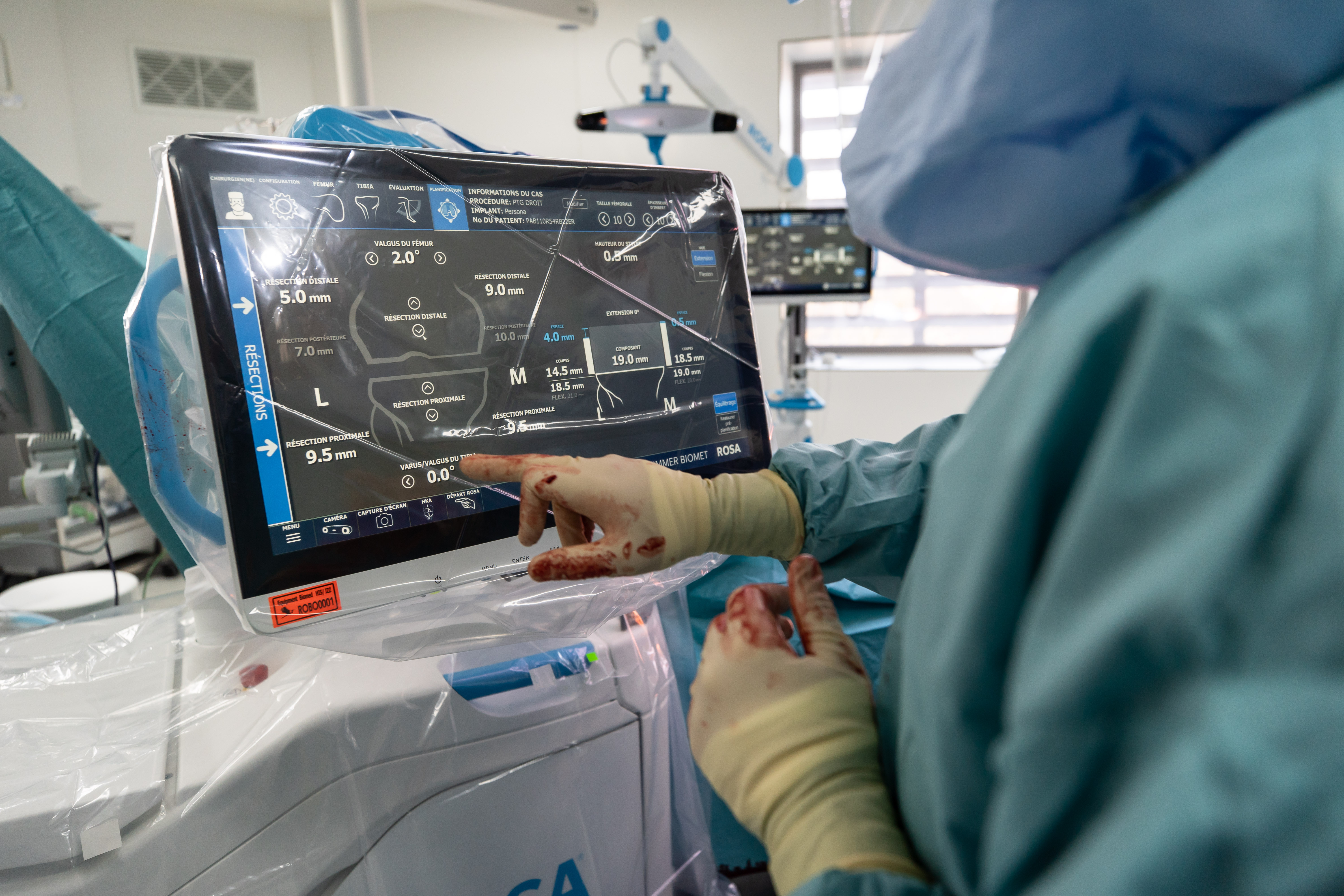 Chirurgie robotisée ROSA prothèse genou Bruxelles